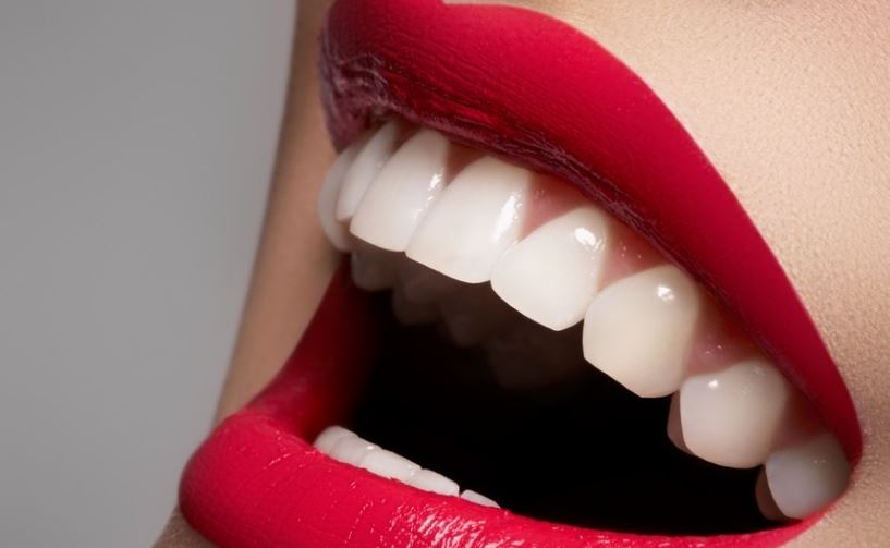 white teeth